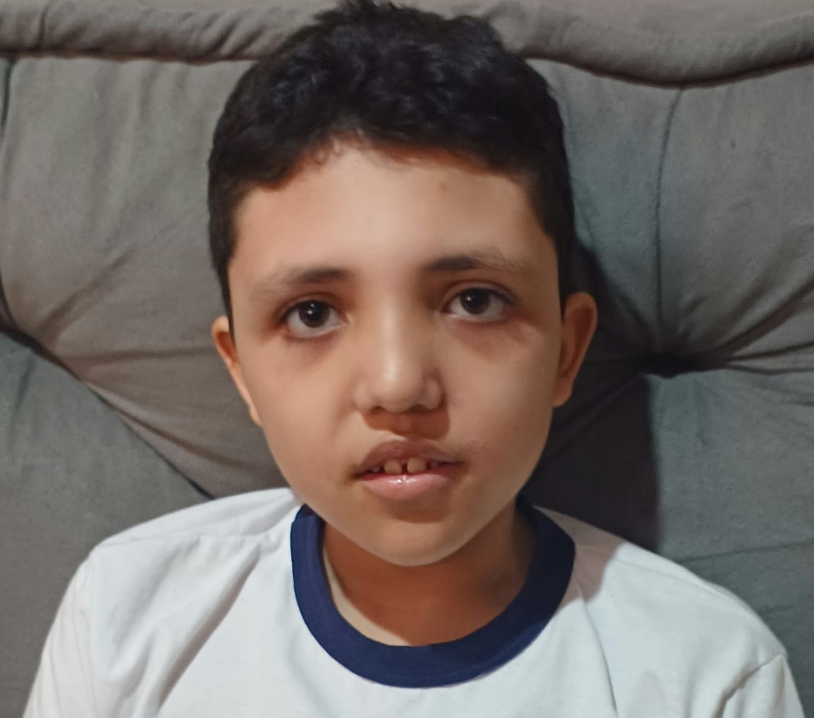 raphael monteiro eplepsia refrataria rj